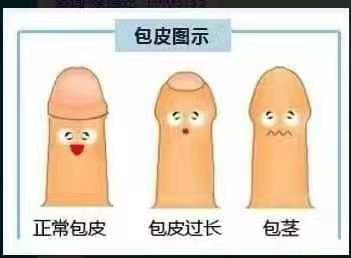 包茎不割会有什么影响？
